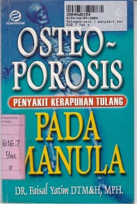 Osteoporosis ( Penyakit Kerapuhan Tulang ) Pada Manula