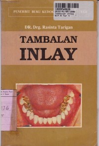 Tambalan Inlay