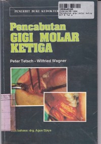 Pencabutan Gigi Molar Ketiga= Operative Extraction of Wisdom Teeth